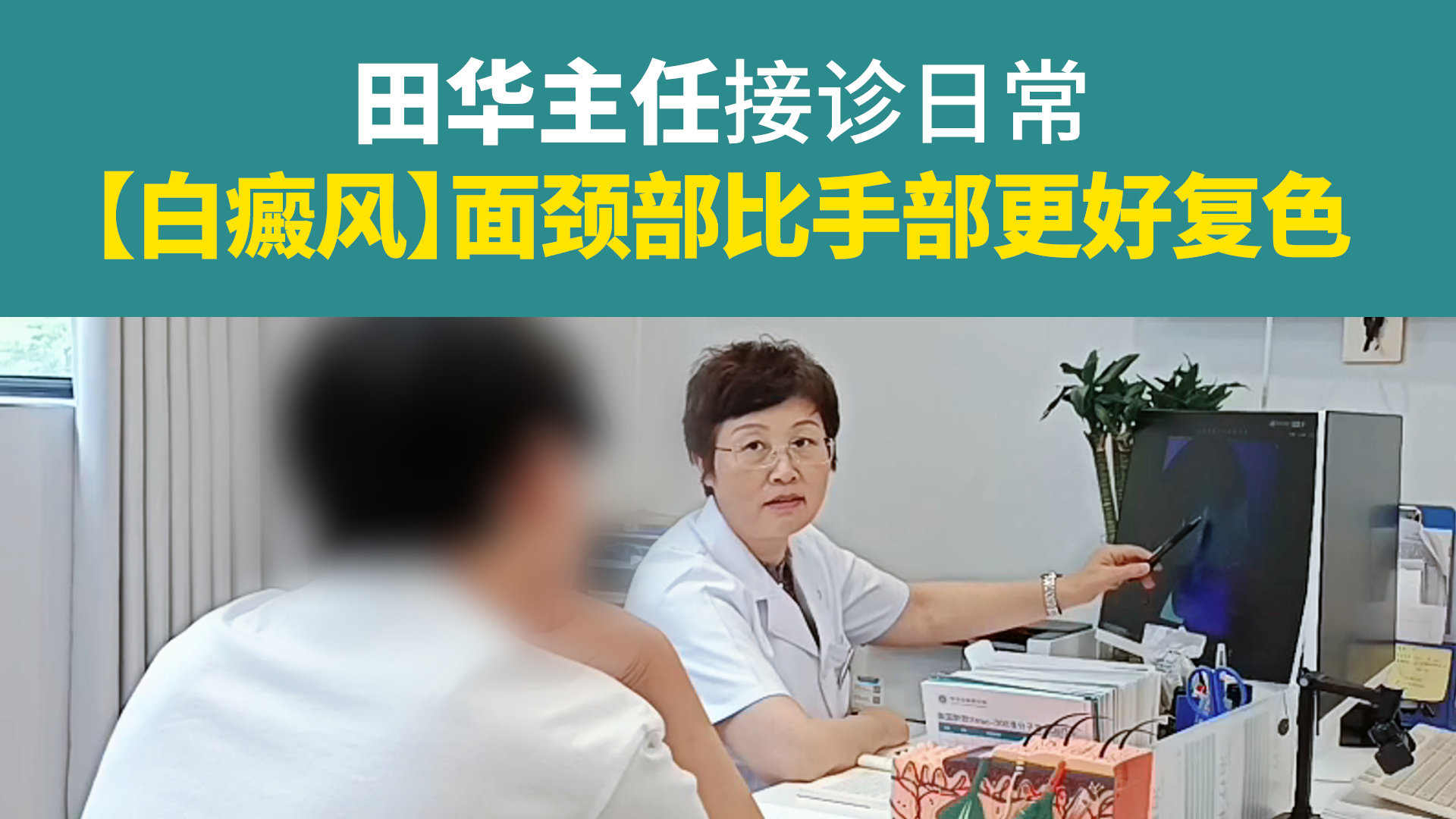 面颈部比手部白癜风更好复色