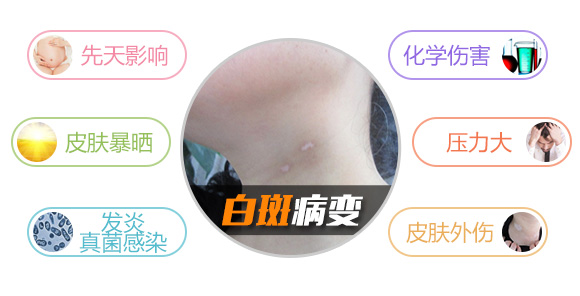 580白斑病变.jpg